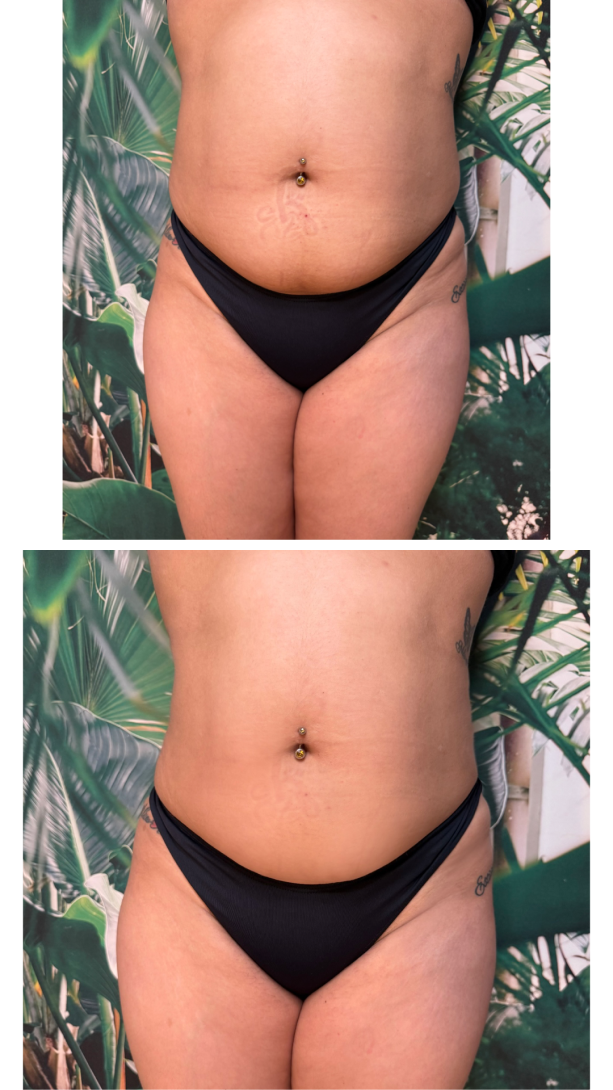 instories_7dae60c5_3170_4162_af55_d2cbee50ba05_1