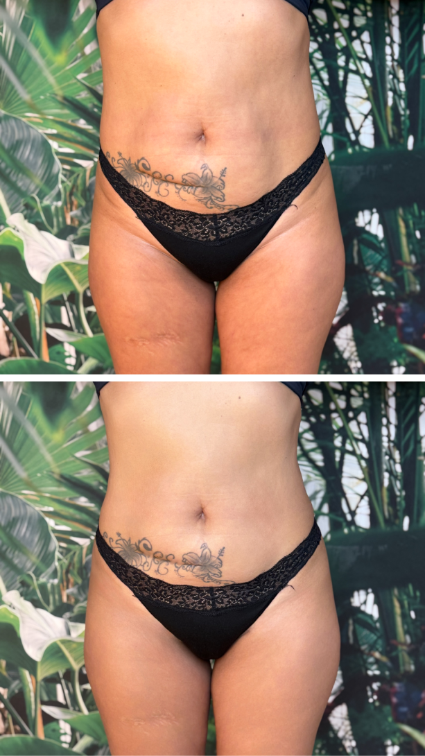 instories_bfeabe5e_e4ad_432d_8e5f_87f4143e13d5_1_1