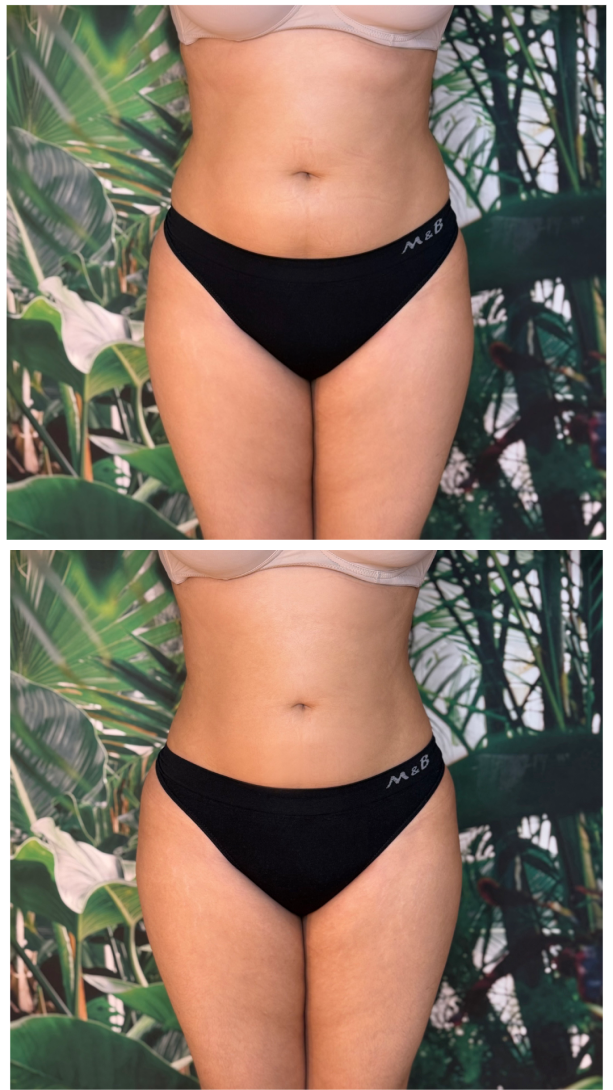 instories_d6f7f24c_045f_4bb8_b4c5_9937cee37ff1_2